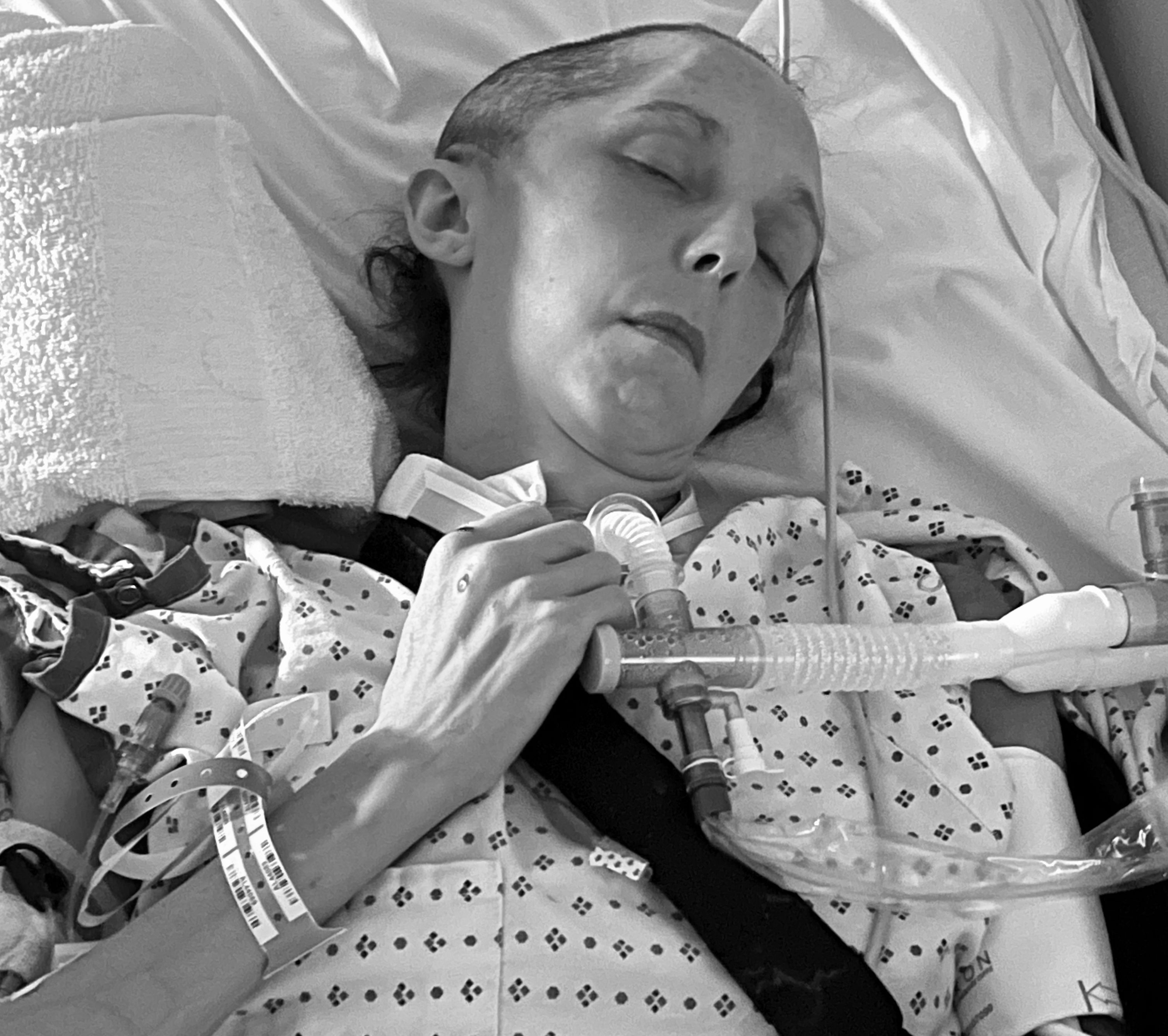 Rachel in recovery, running again.